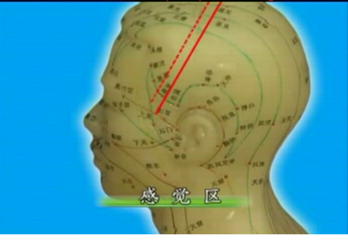 145723v1omtcd3zpn24tt3.png
